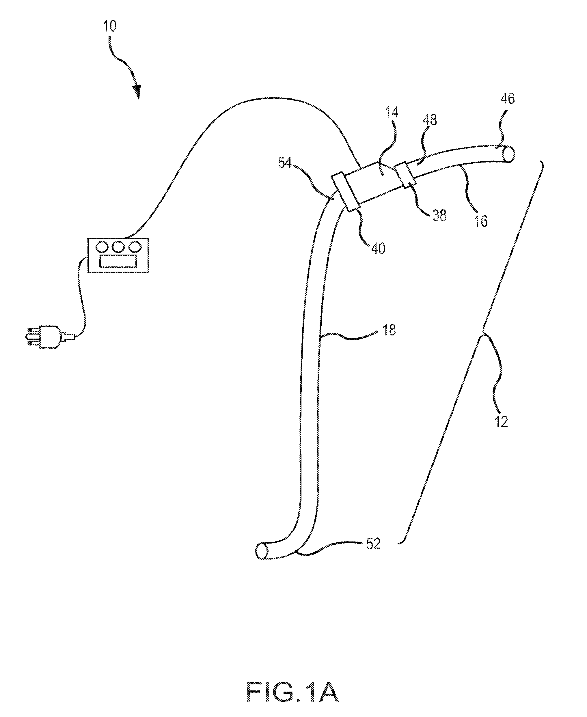 System and method to increase the overall diameter of veins