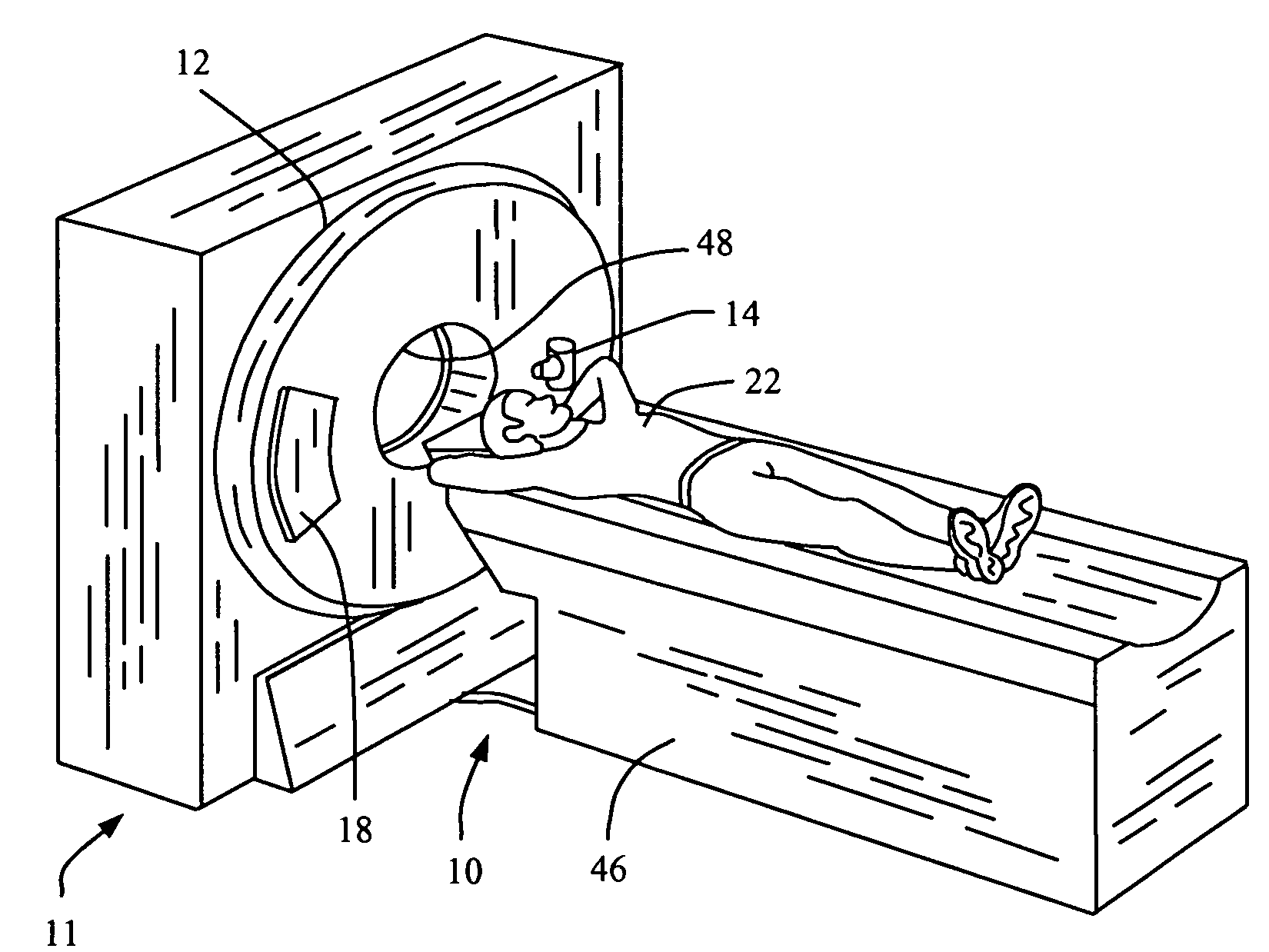 Methods and apparatus for determining component alignment