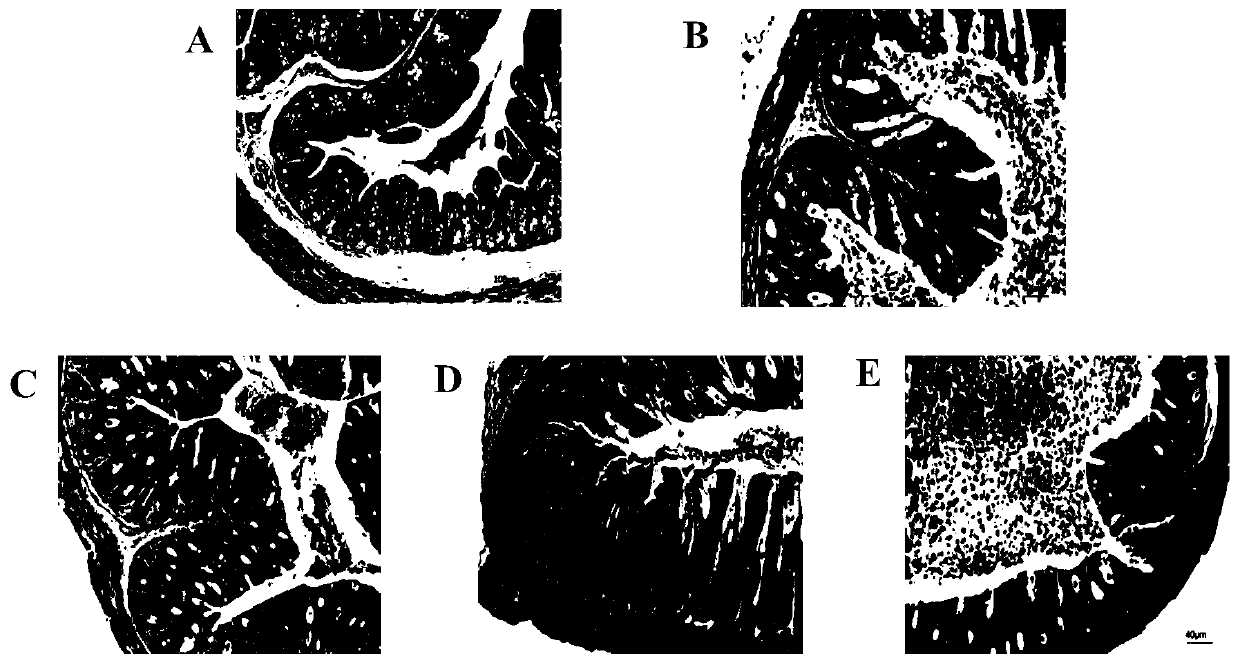 Pediococcus pentosaceae ccfm1012, its fermented food and its application in the preparation of drugs against Campylobacter jejuni infection