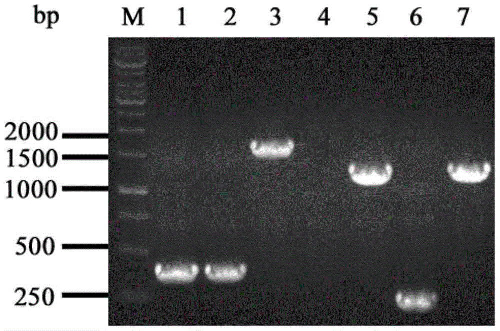 A genetically engineered bacterium producing α-ketobutyric acid and its application