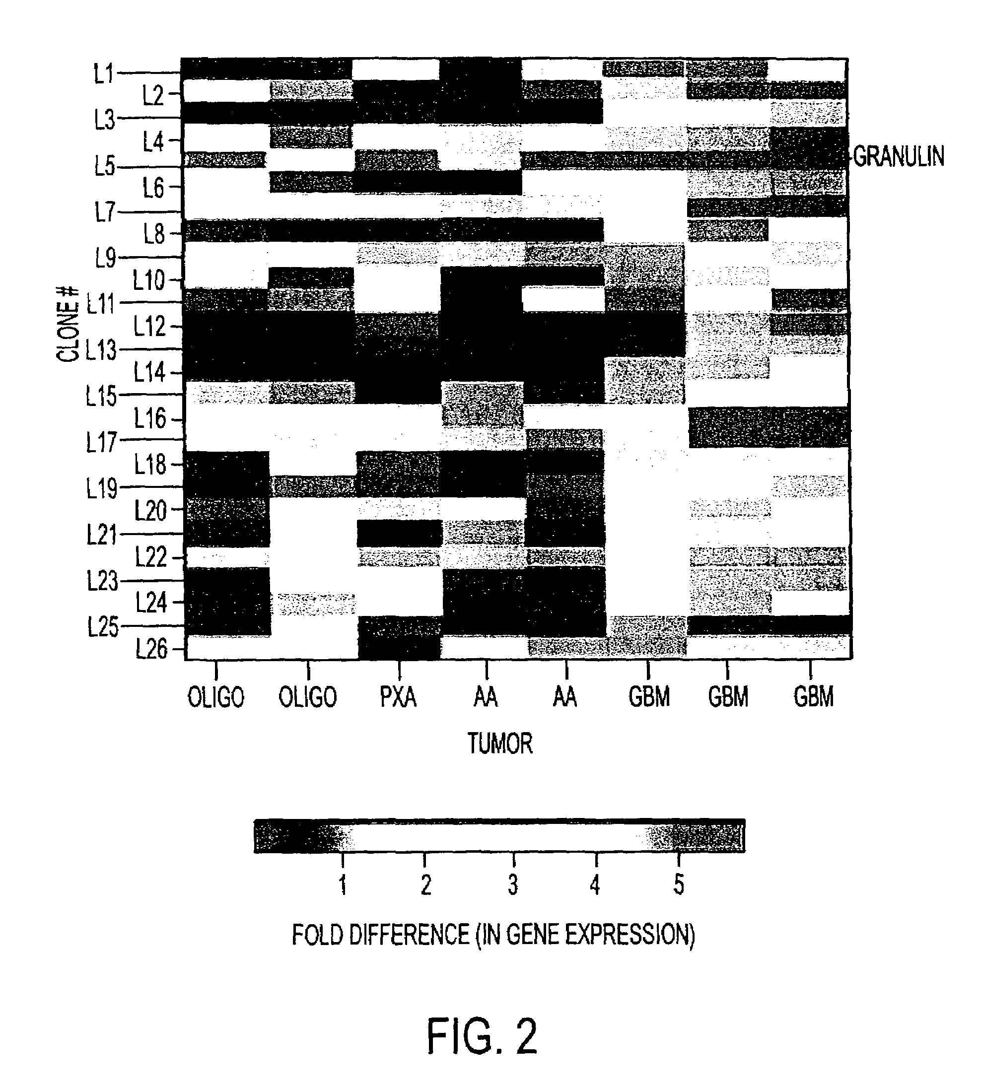 Methods for detection and treatment of neural cancers