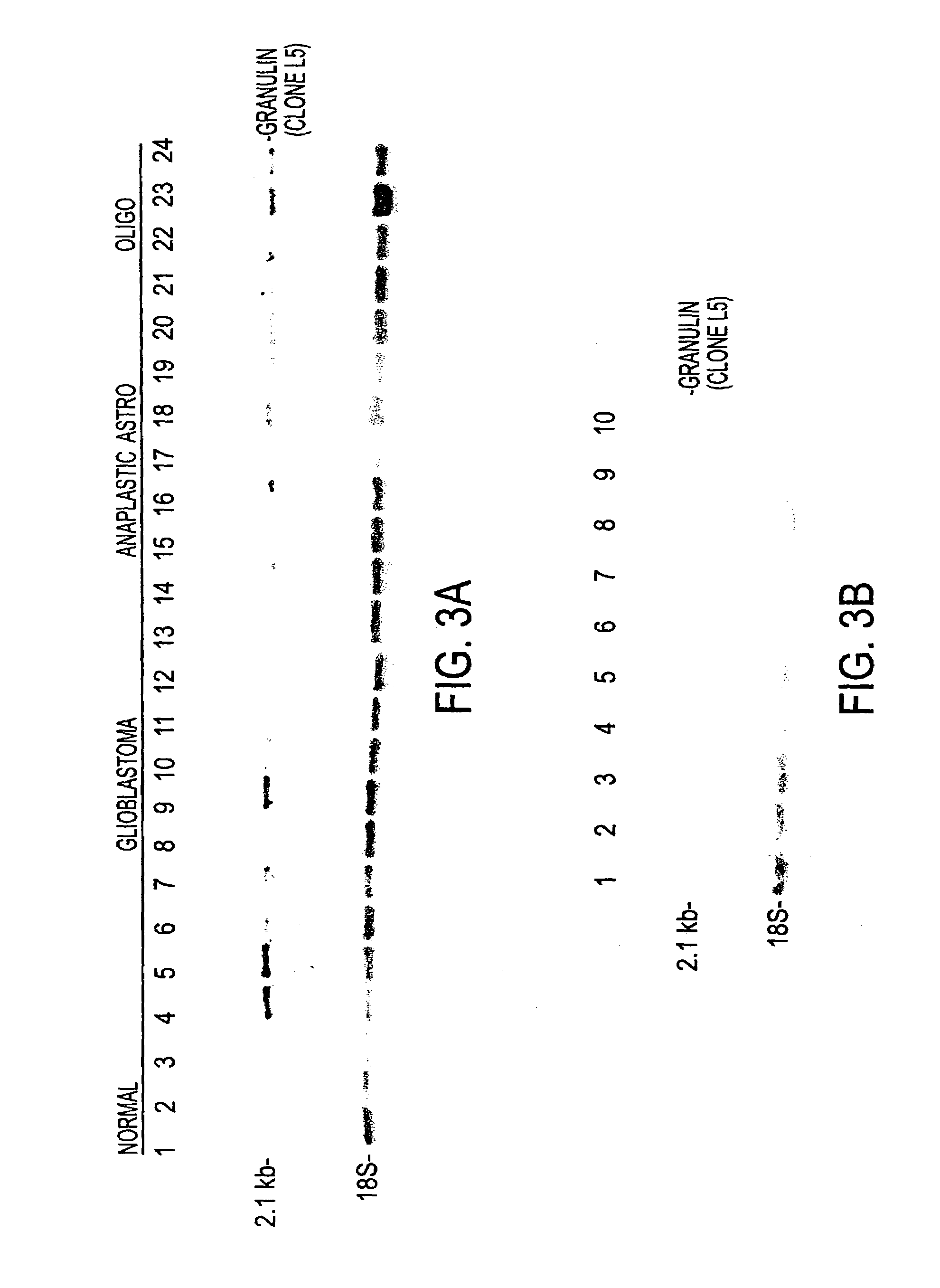 Methods for detection and treatment of neural cancers