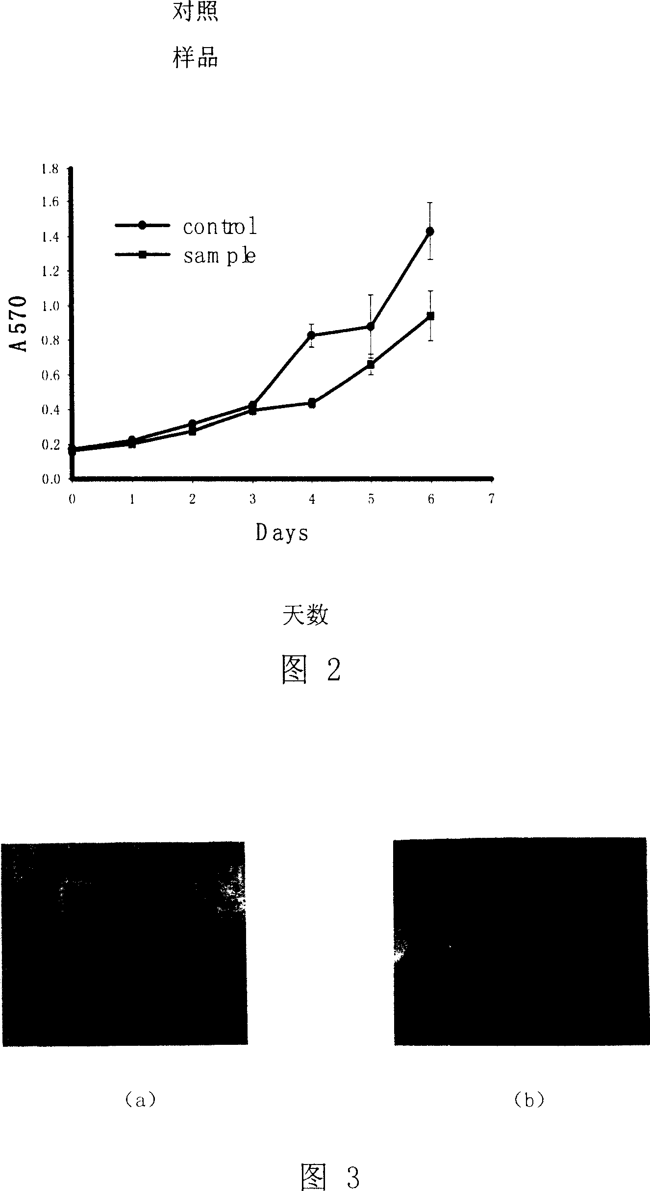 Anti cancer gene medicinal composition, micromolecule interfere RNA and its filtrate method