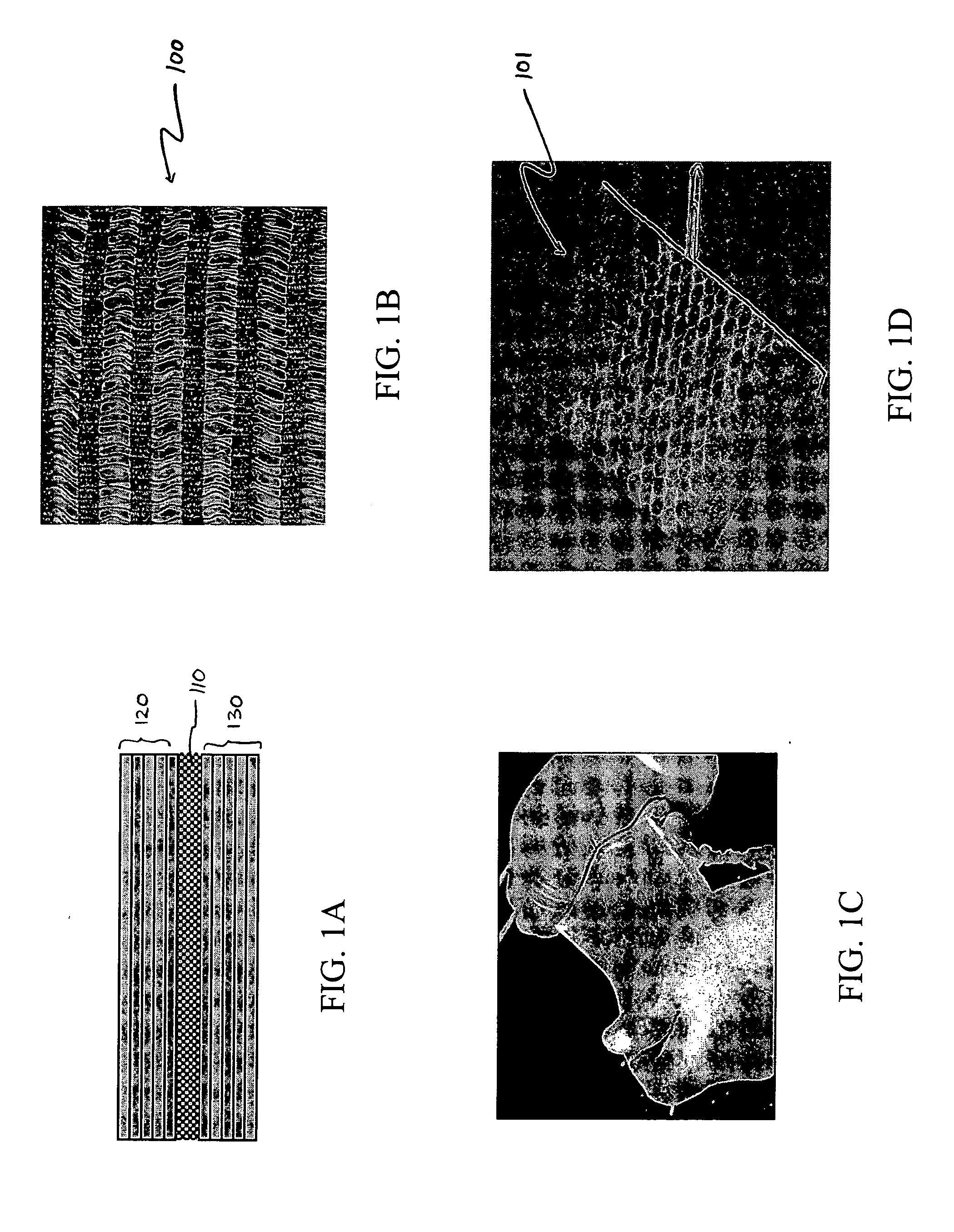 Devices for intervertebral augmentation and methods of controlling their delivery