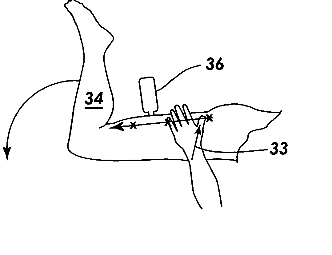 Method of normalizing soft tissue