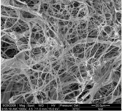 Method for preparing nanometer cellulose fiber through combining ultrasound and high-pressure homogenization treatment