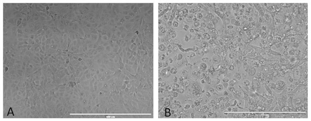 A kind of method that utilizes suspension cell line to prepare Seneca virus