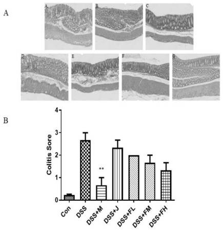 Application of ar-turmerone in preparation of product for preventing and treating ulcerative colitis and regulating intestinal florae