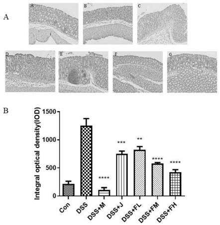 Application of ar-turmerone in preparation of product for preventing and treating ulcerative colitis and regulating intestinal florae