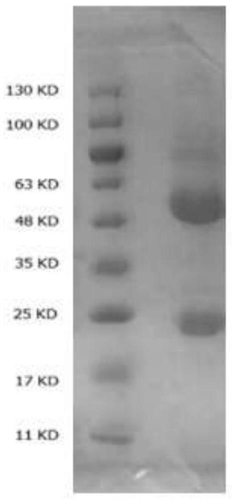 Preparation and application of an anti-cryptococcal capsular polysaccharide monoclonal antibody and its hybridoma cell line