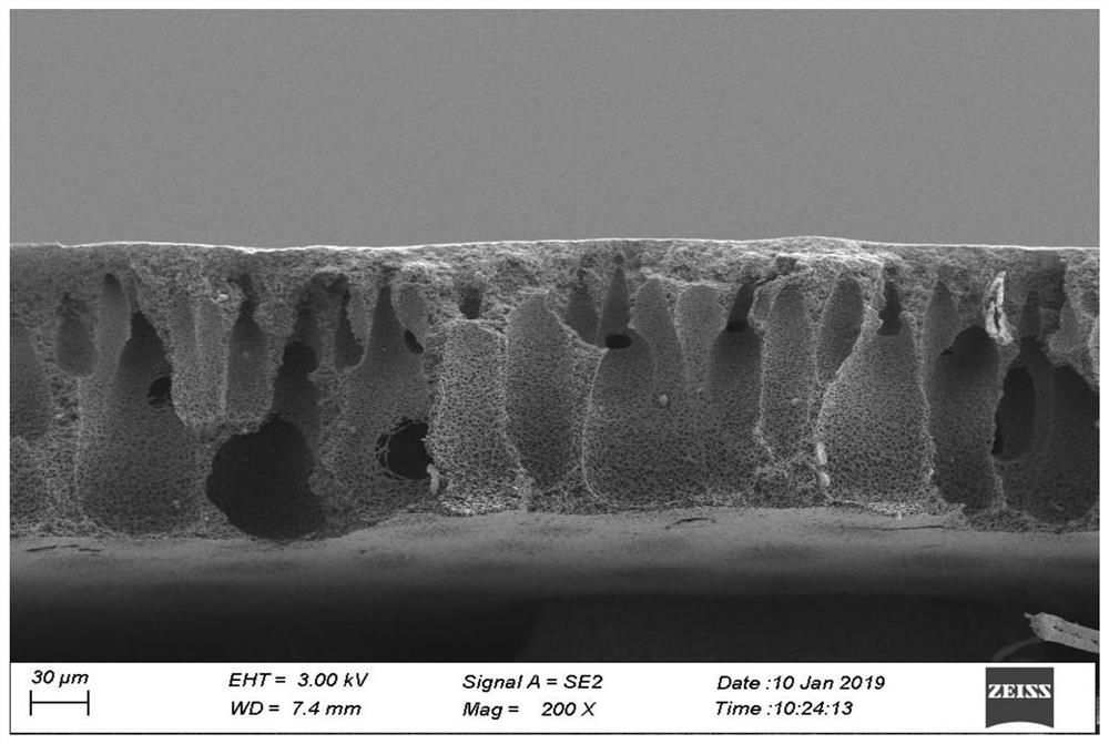 A gradient functional organic-inorganic hybrid membrane for advanced water treatment and its preparation method