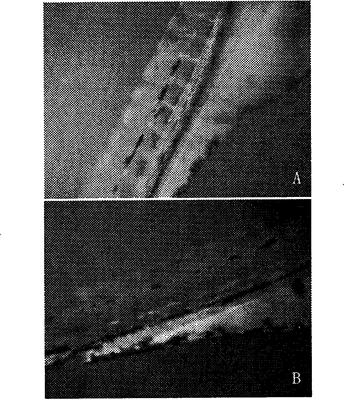 Antineoplastic medicine composition and application thereof
