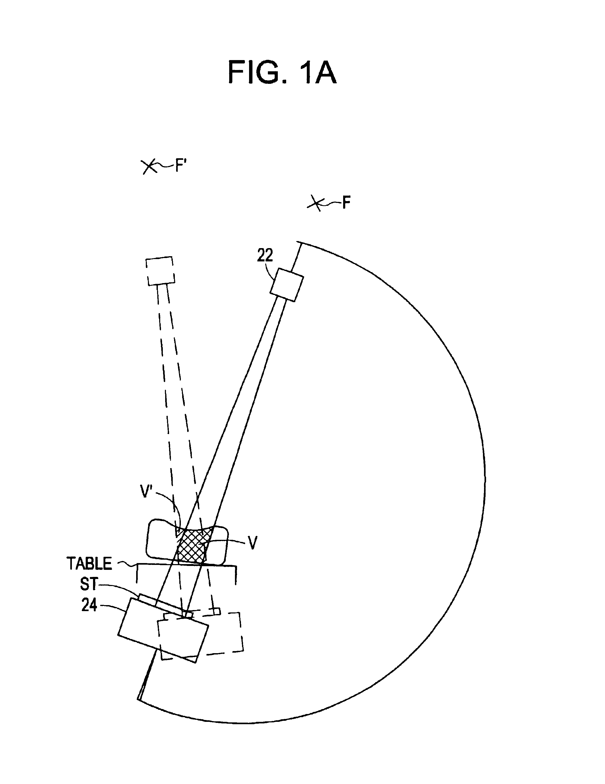 Fluoroscopic tracking and visualization system