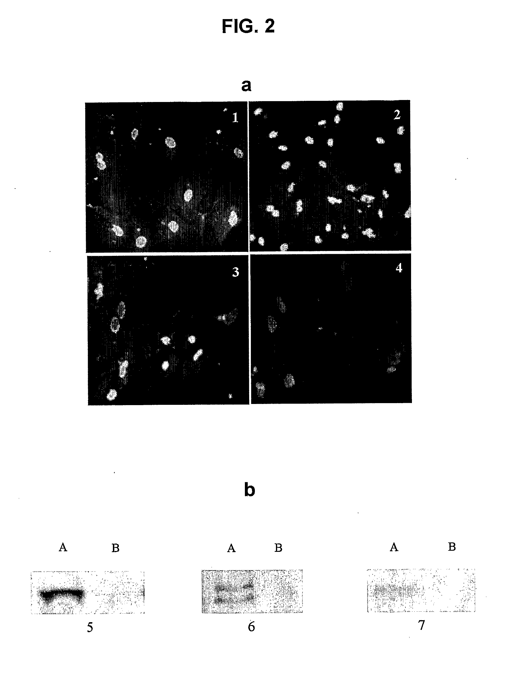 Pharmaceutical composition and method for regenerating myofibers in the treatment of muscle injuries