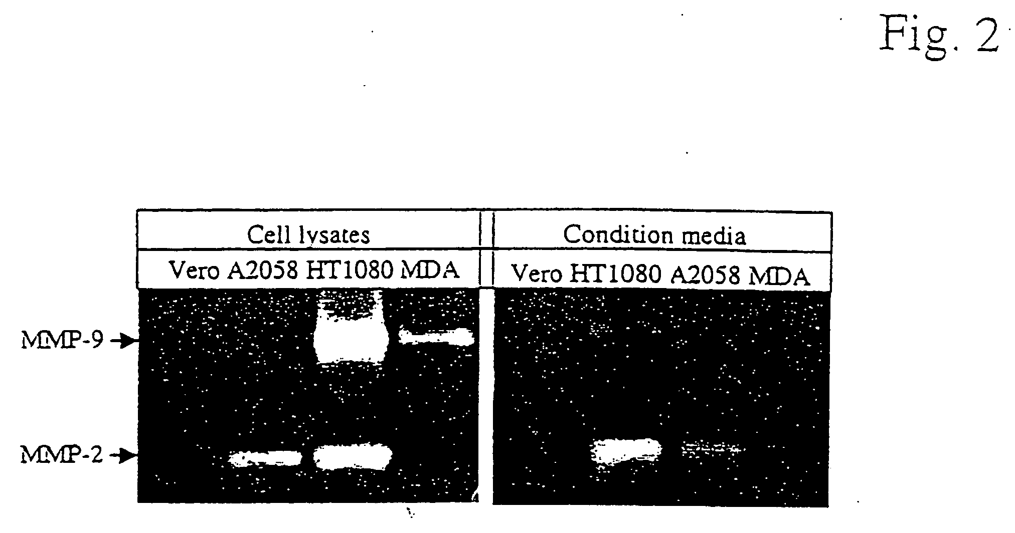 Mutated anthrax toxin protective antigen proteins that specifically target cells containing high amounts of cell-surface metalloproteinases or plasminogen activator receptors
