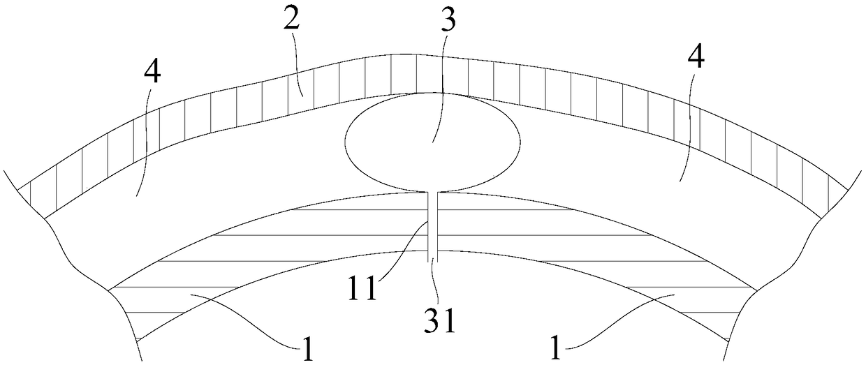 A Limiting Method to Prevent the Displacement of Empty Pushing Segment in Shield