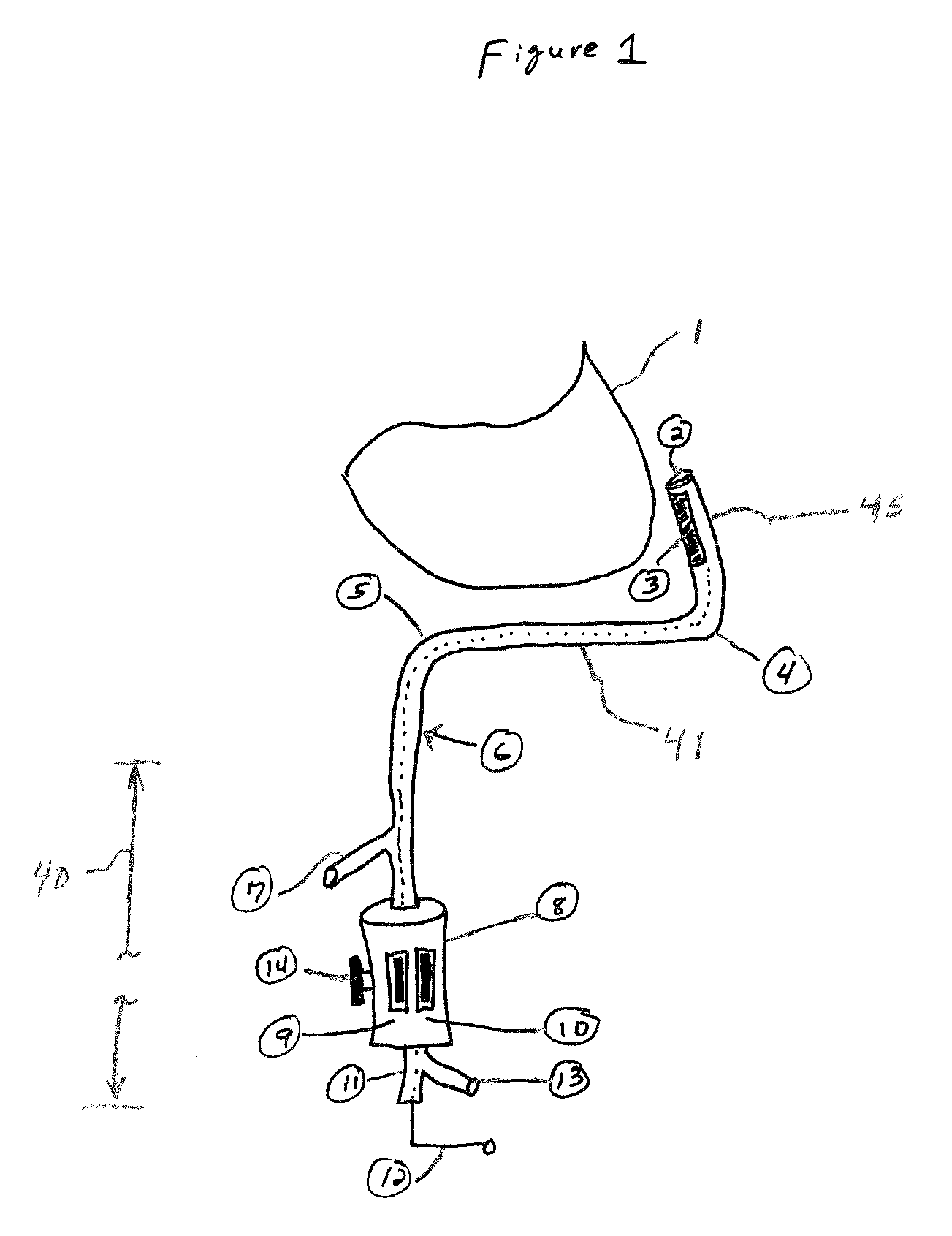 Electrode catheter for ablation purposes and related method thereof
