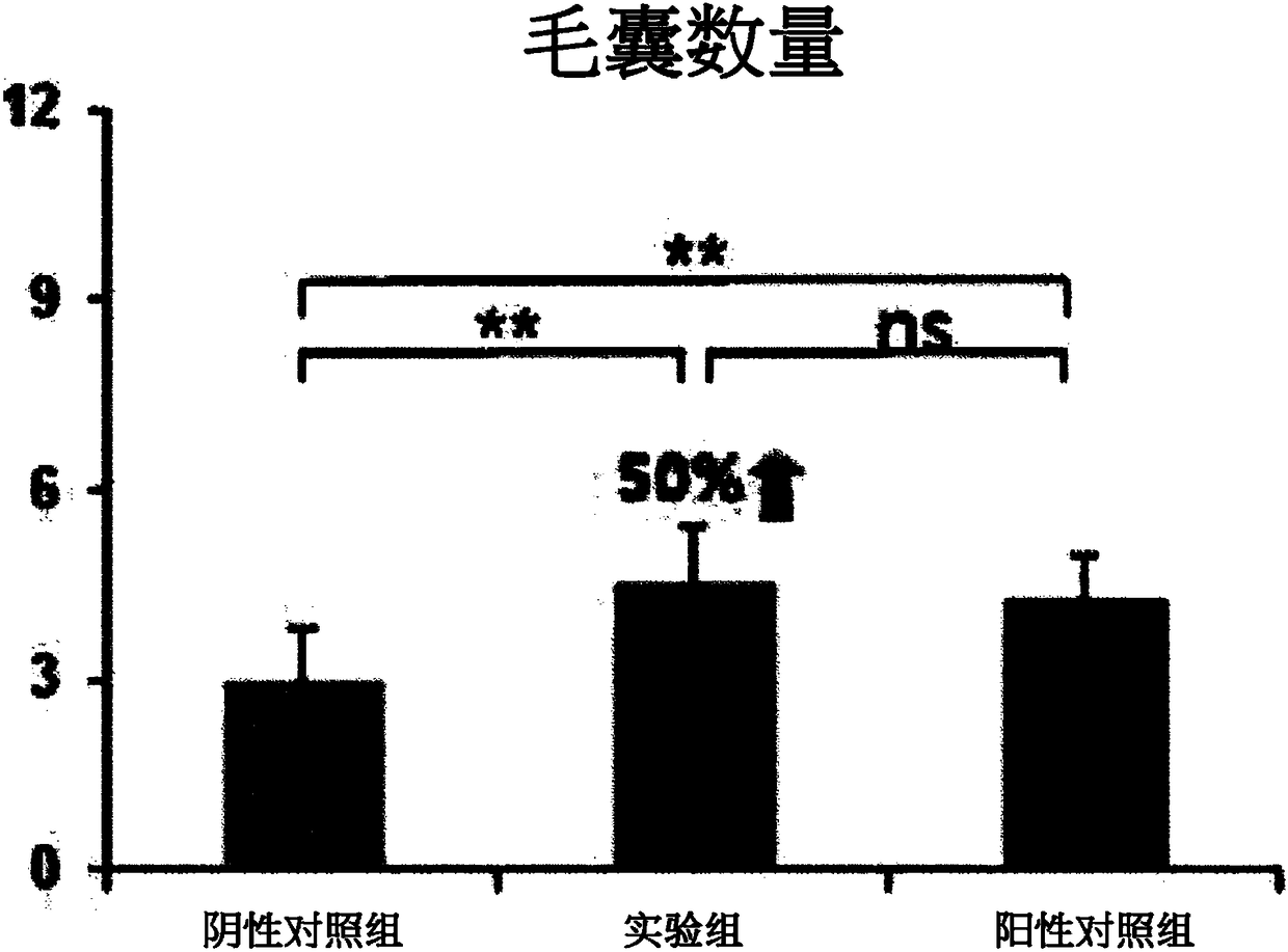 Composition for preventing or treating hair loss or promoting hair growth or hair restoration comprising diosmin as active ingredient