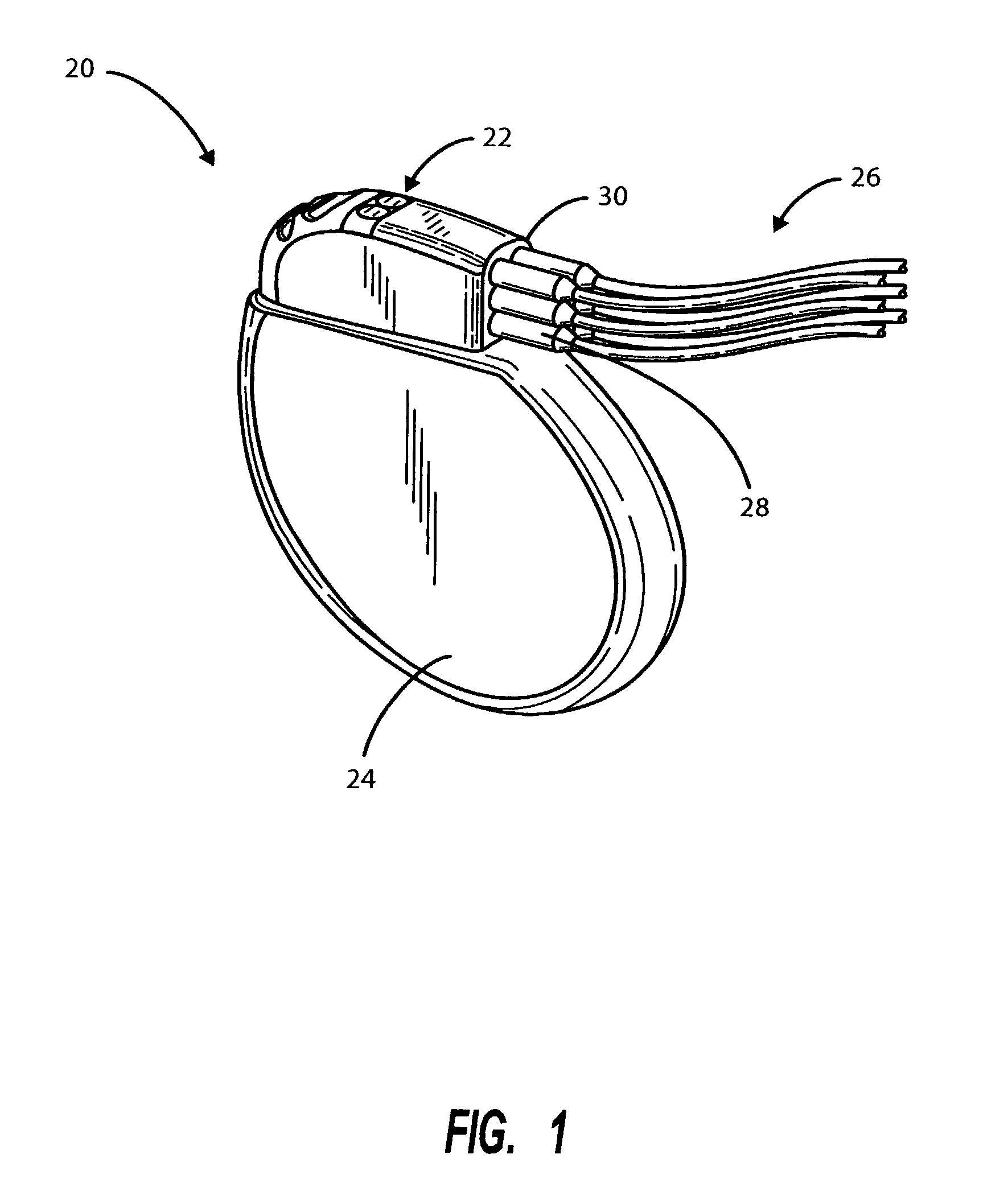 Interconnect for implantable medical device header