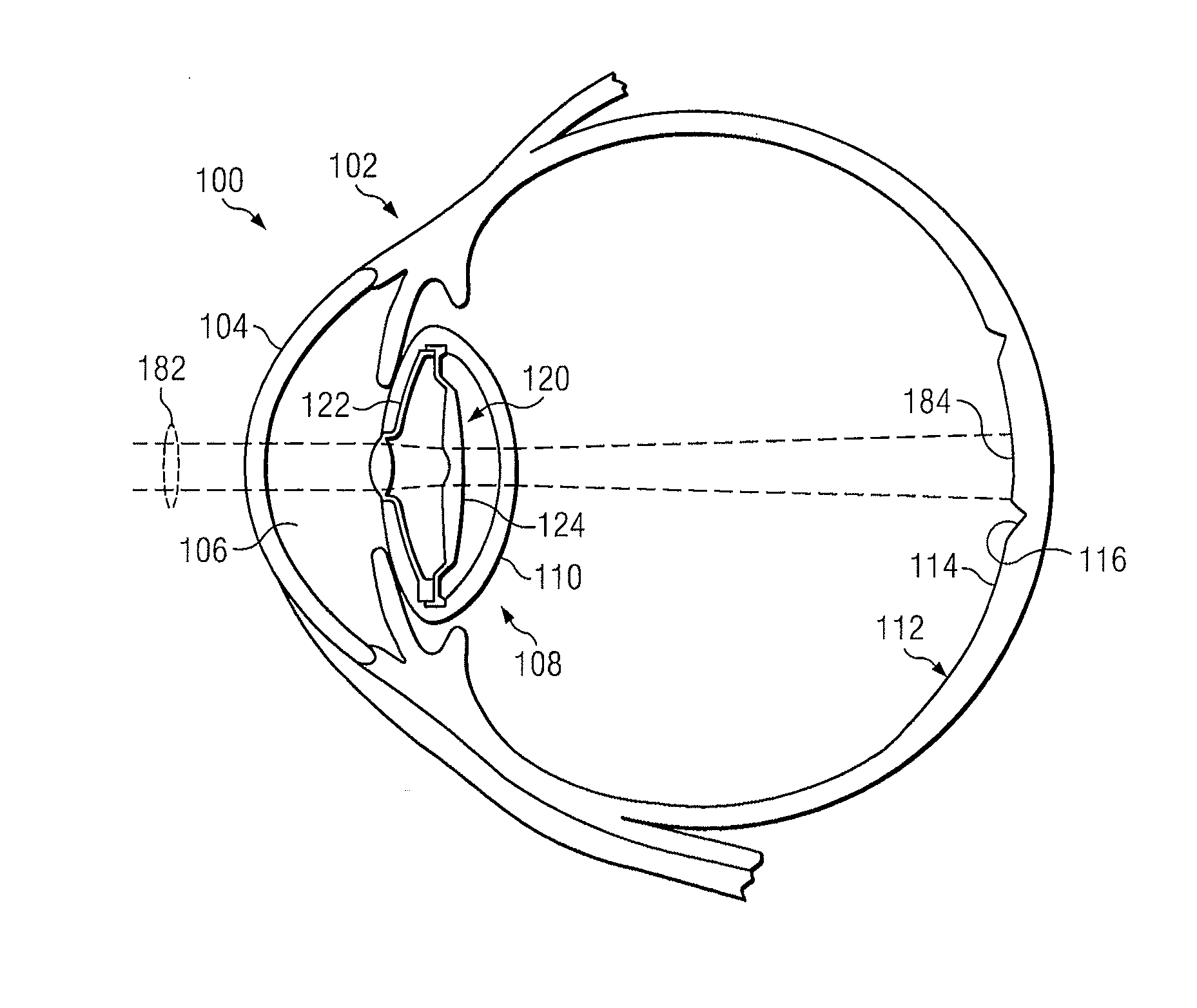 Intraocular devices and associated methods
