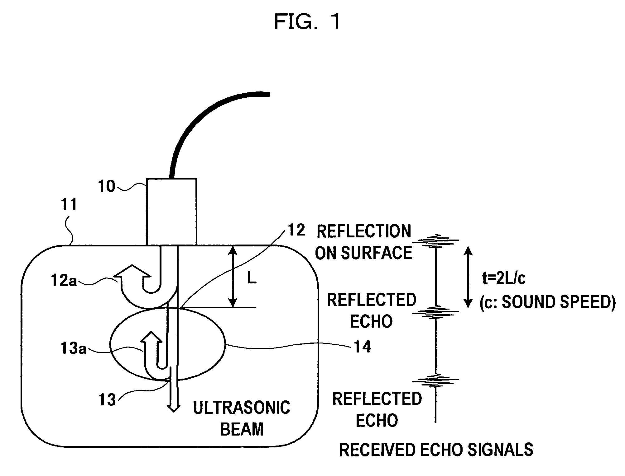 Ultrasonic diagnosis system and strain distribution display method