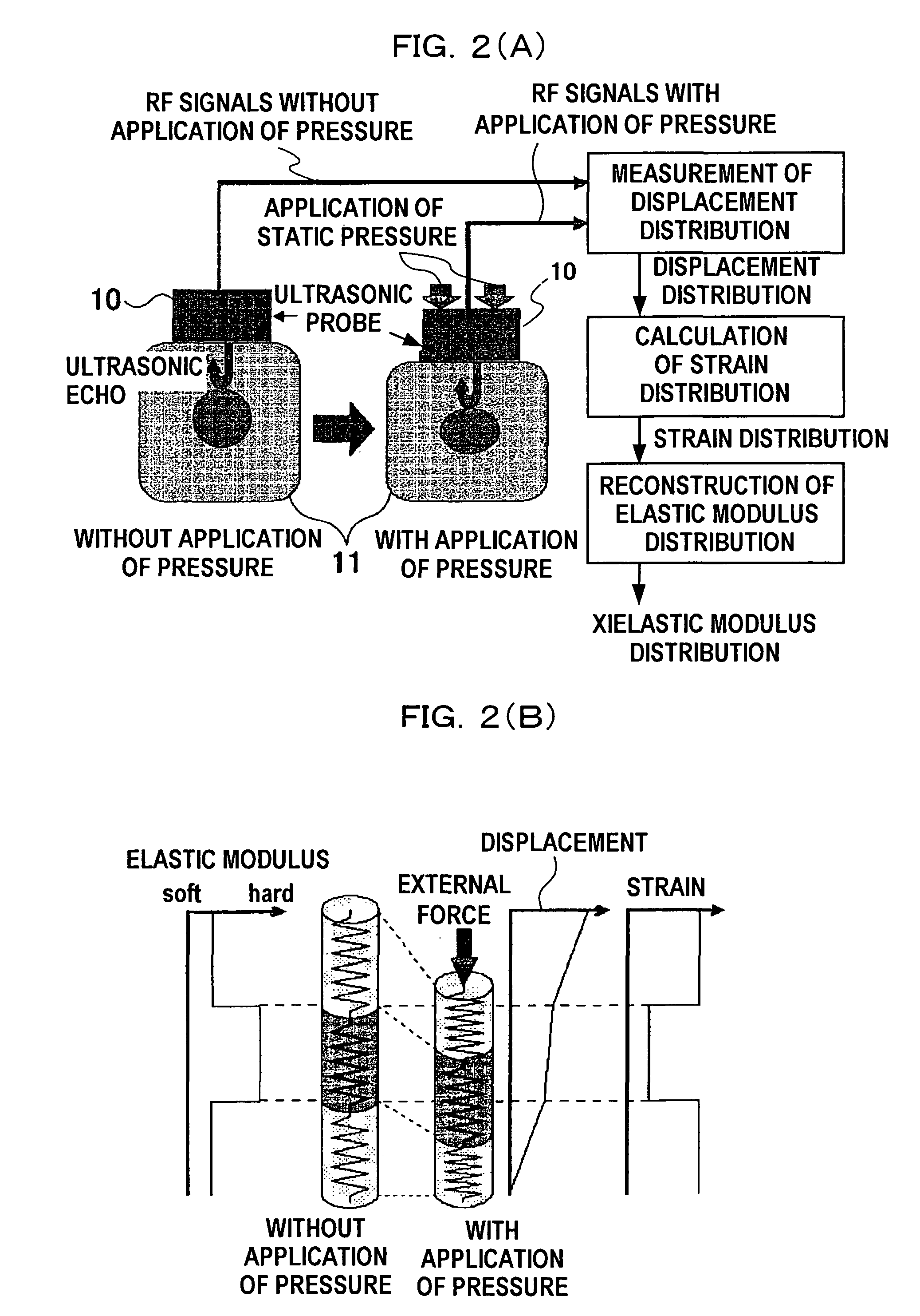 Ultrasonic diagnosis system and strain distribution display method