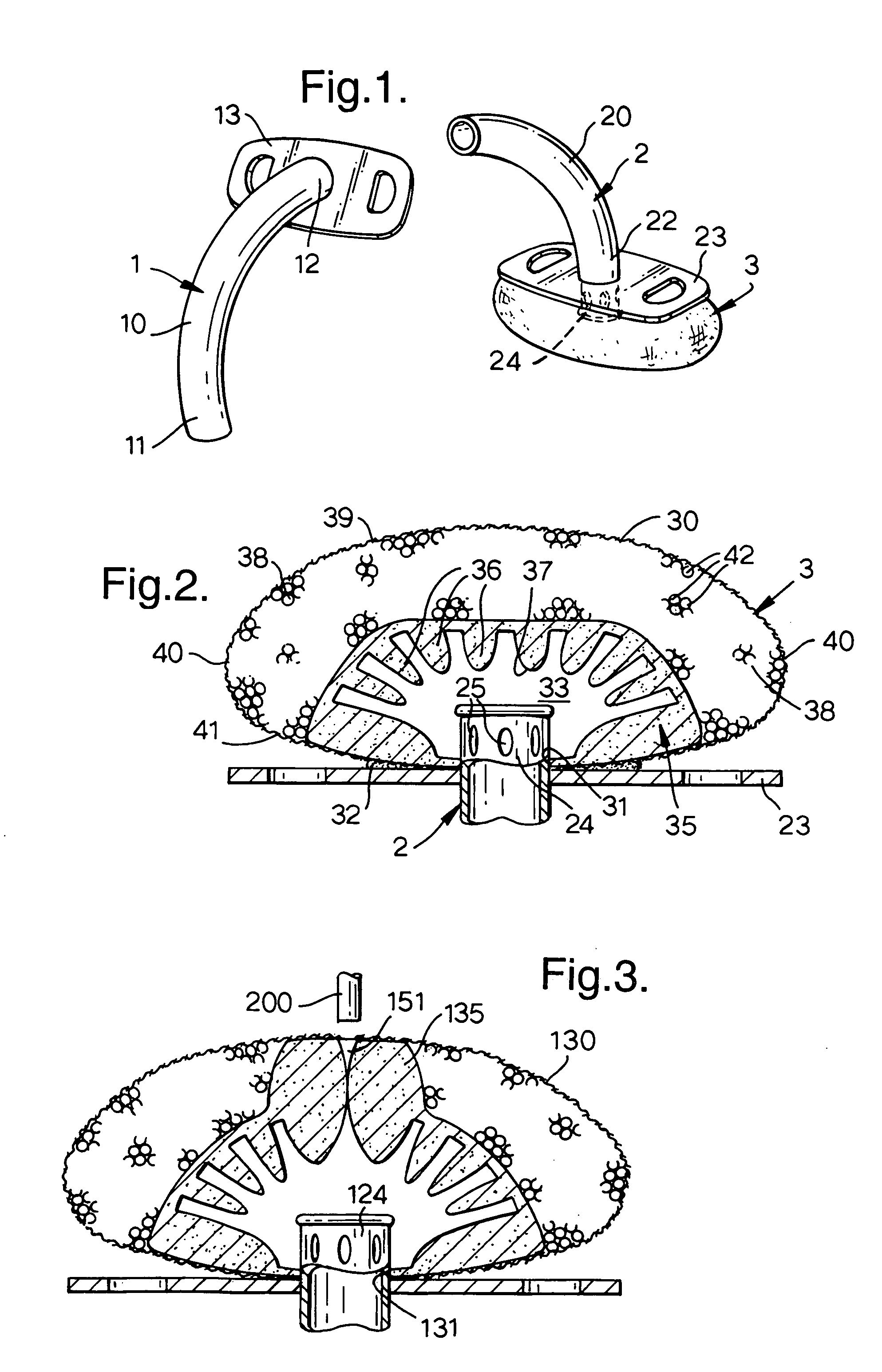 Gas-treatment devices