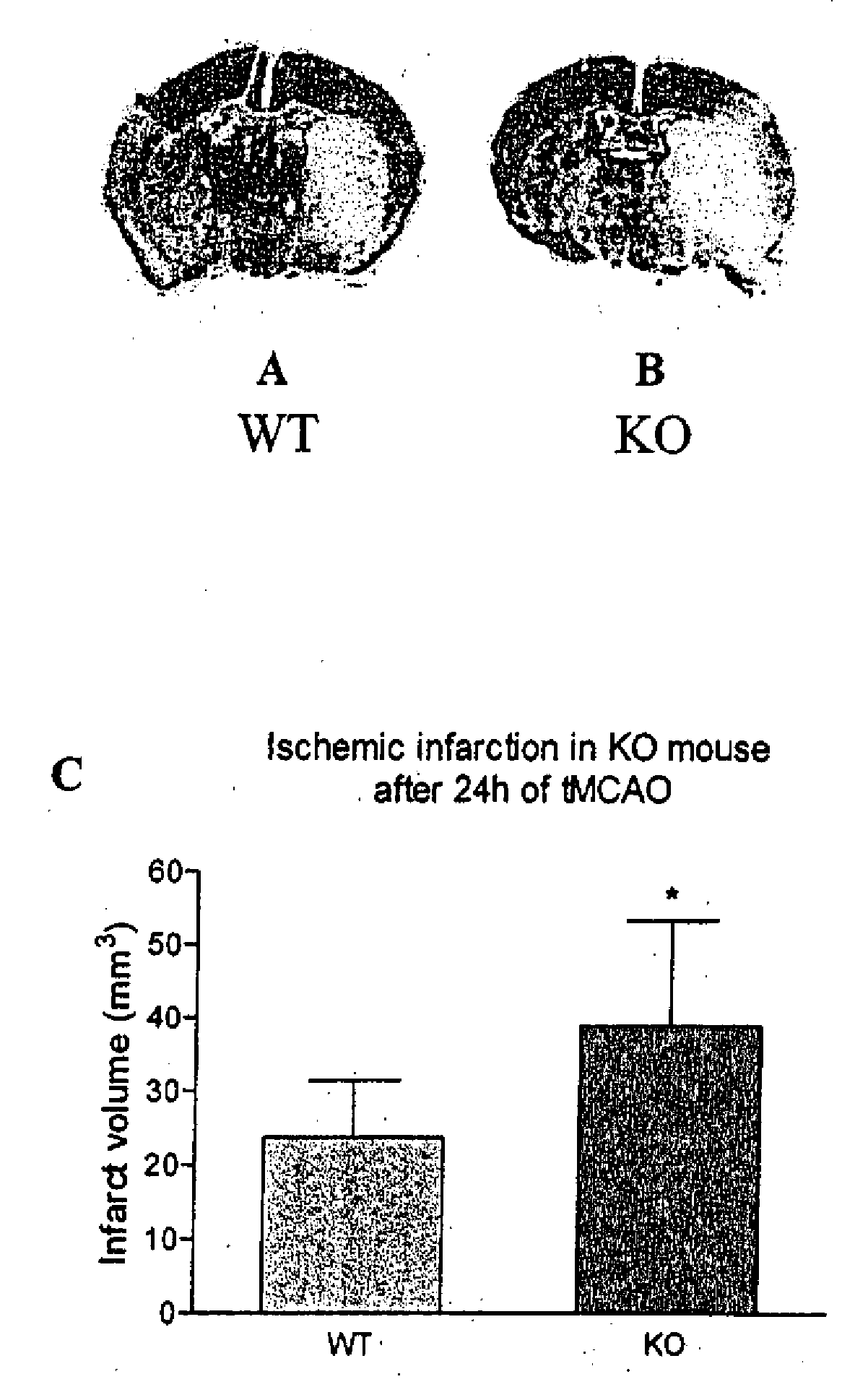 Method of preventing and treating brain infarction