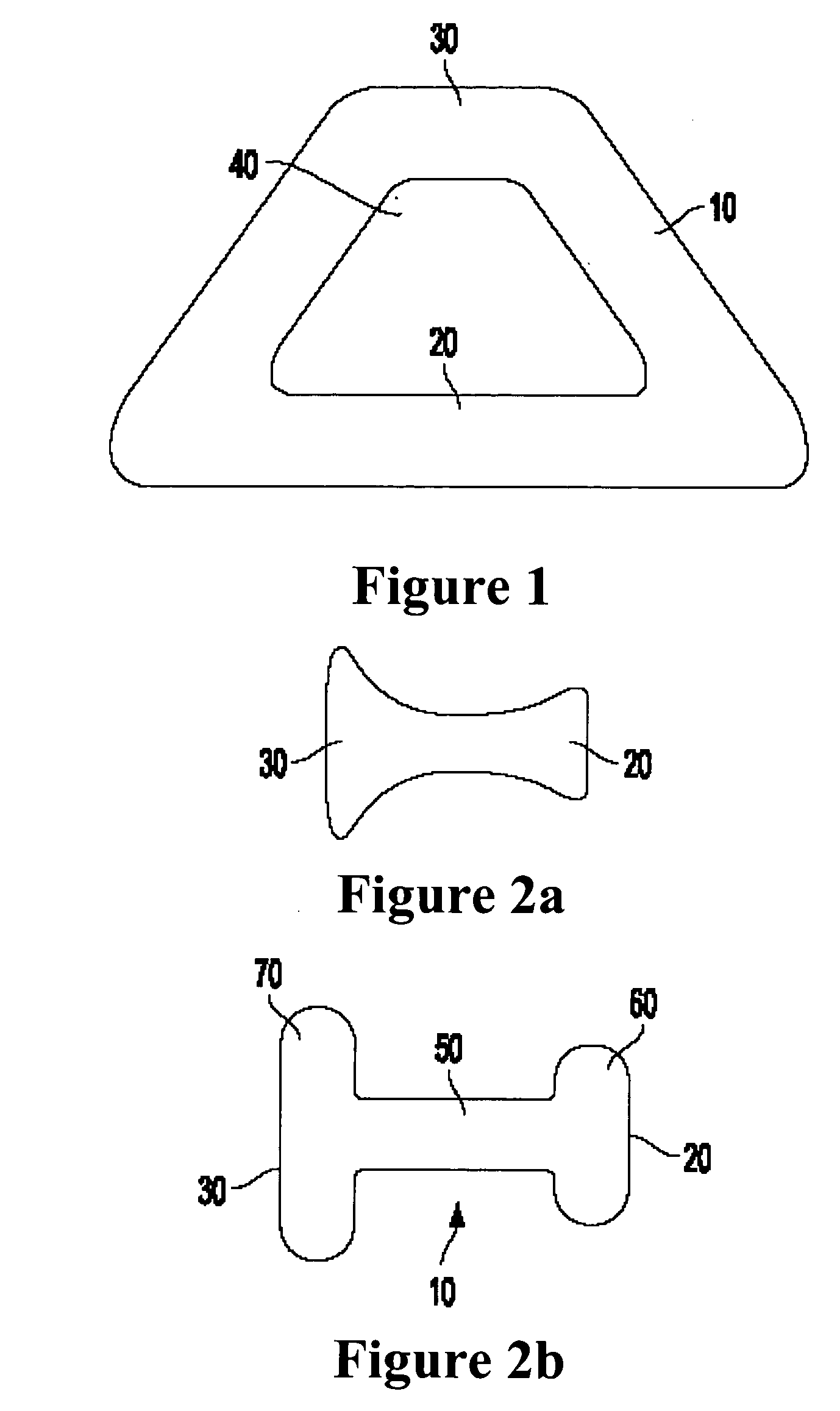 Medical implant and method of reducing back pain