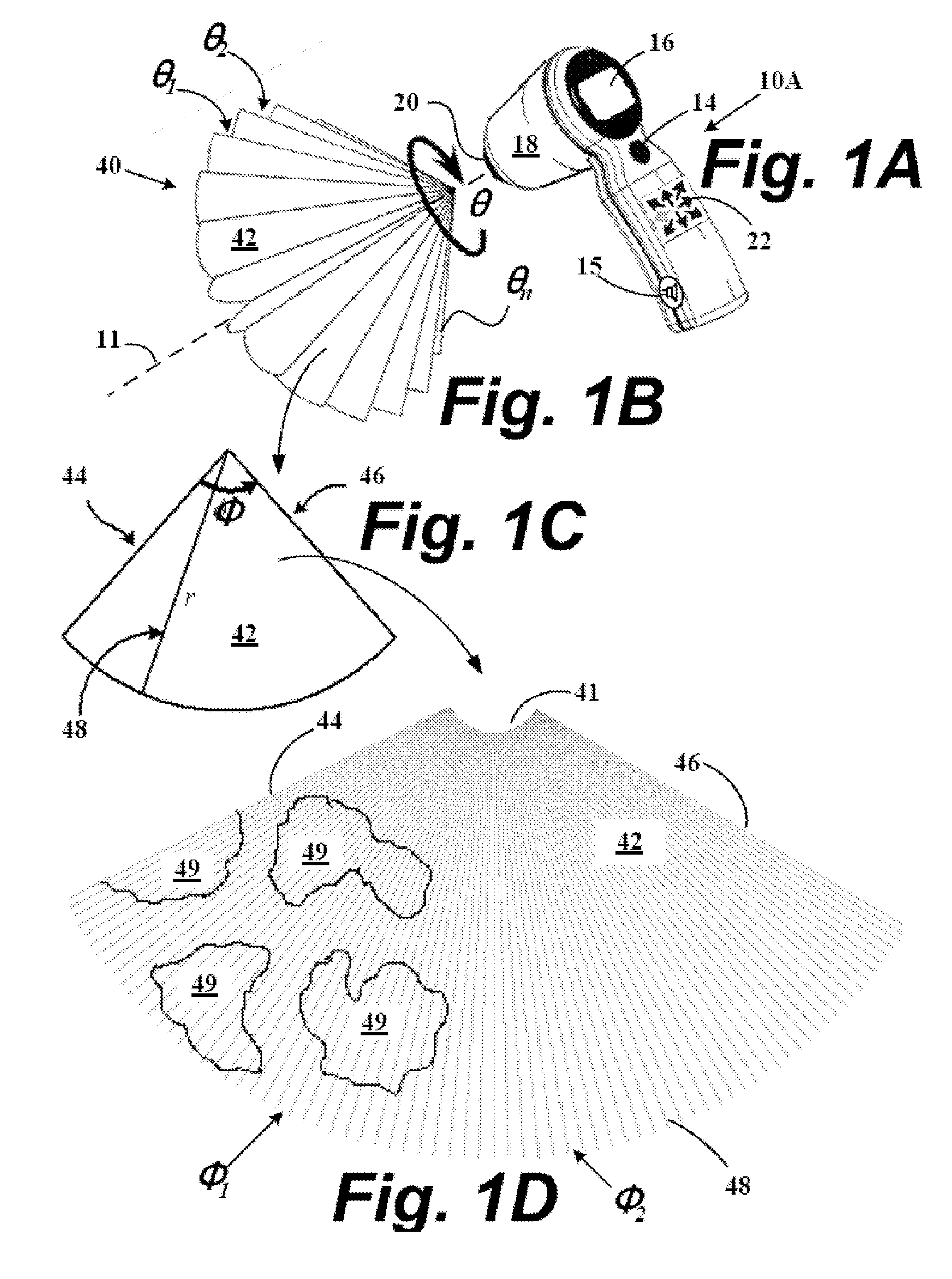 System and method to identify and measure organ wall boundaries