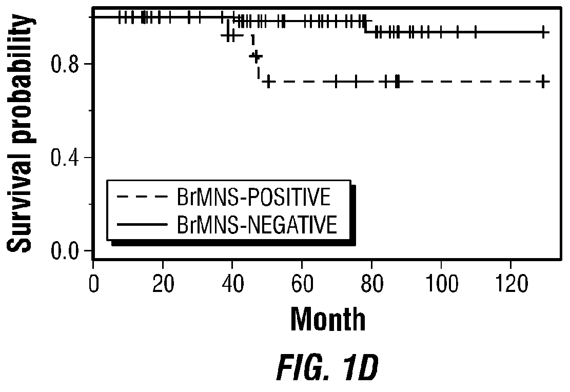 Molecular diagnostic methods for predicting brain metastasis of breast cancer