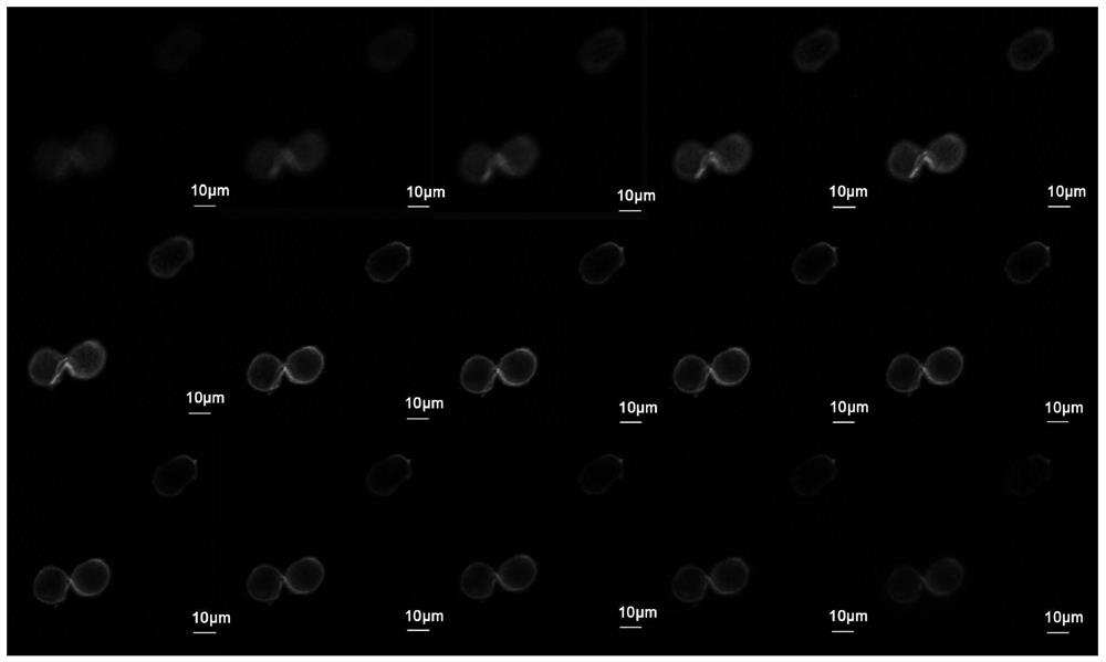 A method for distinguishing teliospores of Tilletia dwarfis and teliospores of Tilletia glabris