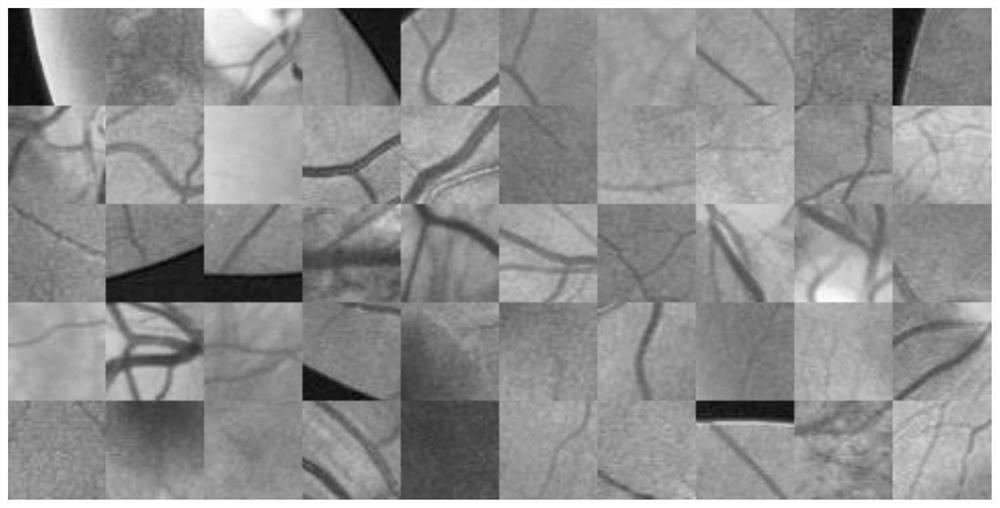 Retinal blood vessel image segmentation method based on double-channel U-shaped improved Transform network