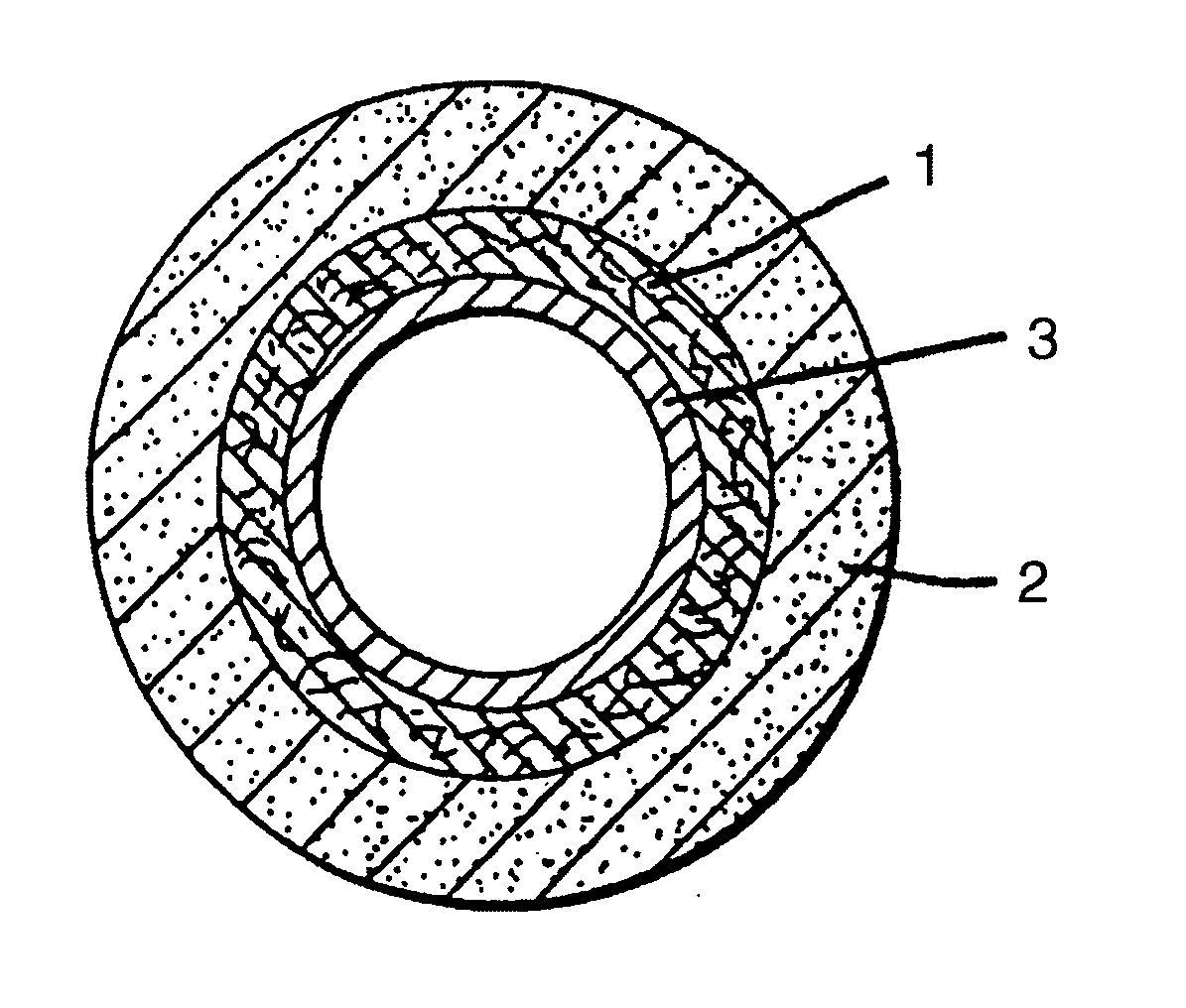 Orthopedic cast system and method