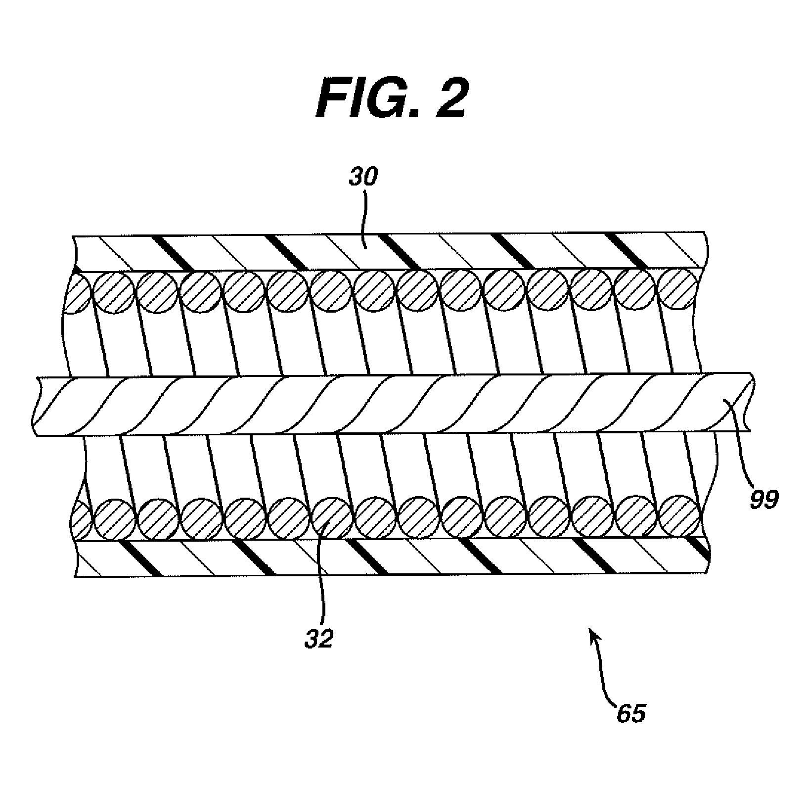 Actuation Apparatus and Method