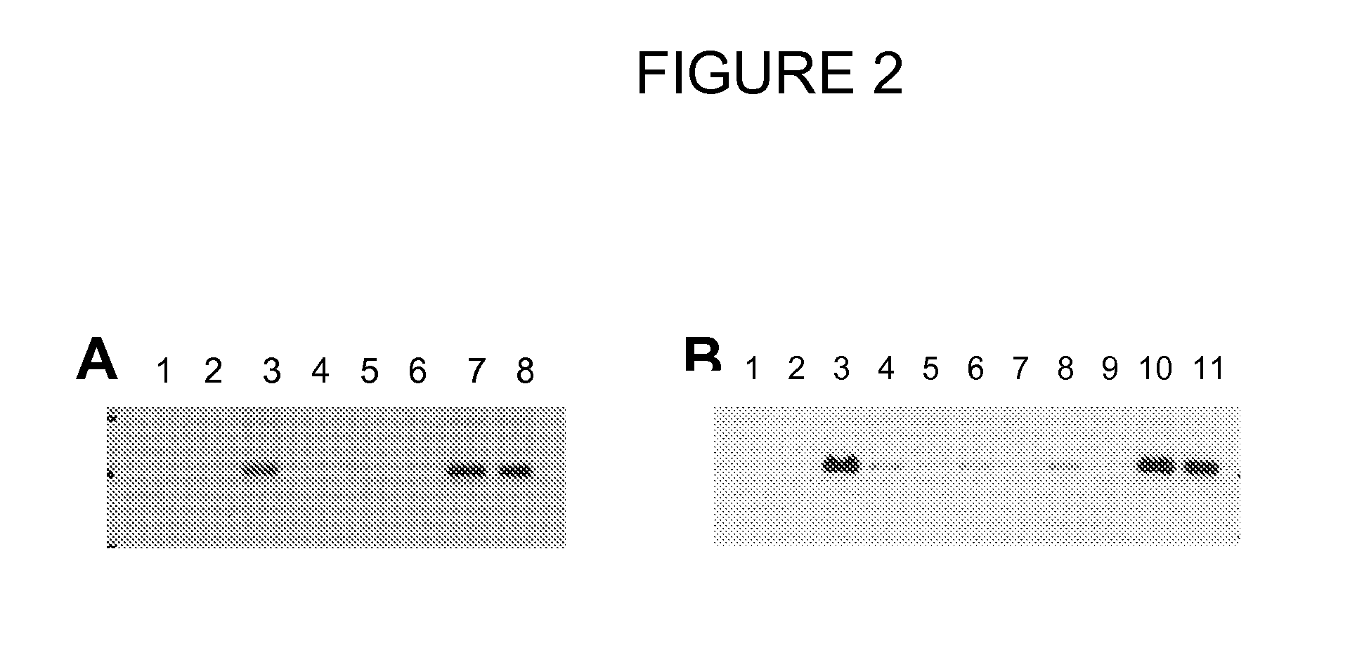 Dkk1 antibodies and methods of use