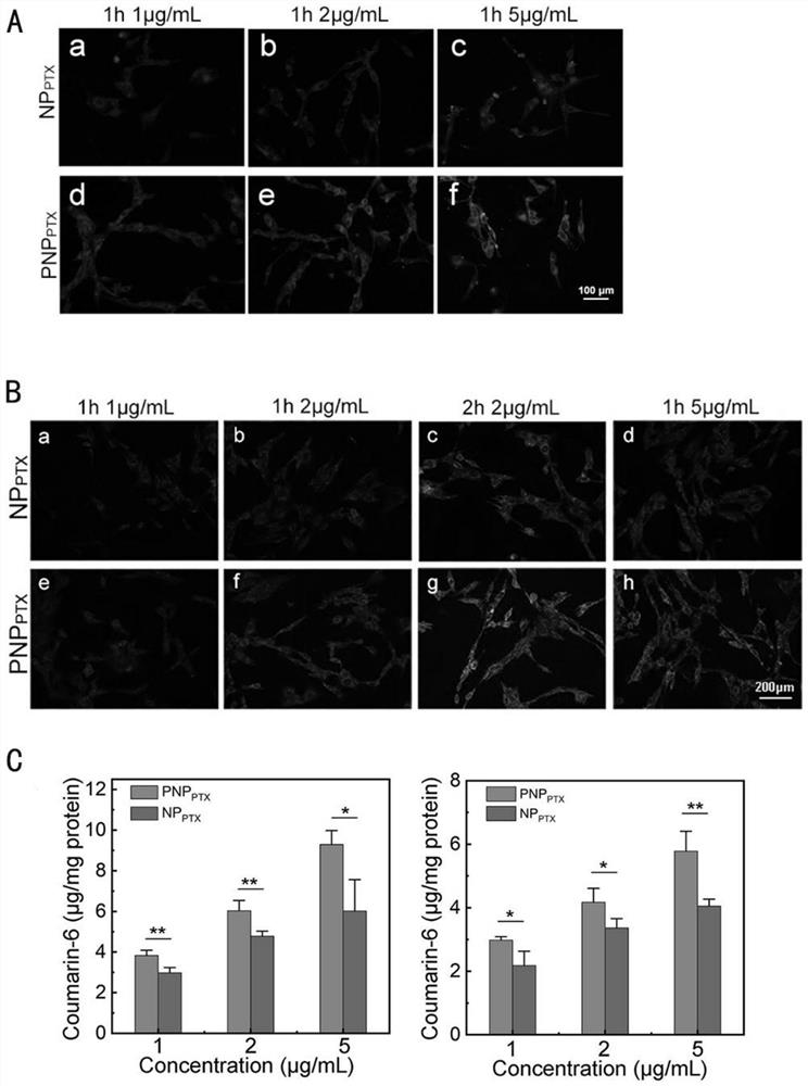 Slow-release gel drug delivery system for postoperative intracavitary chemotherapy/immune co-treatment as well as preparation method and application of sustained-release gel drug delivery system