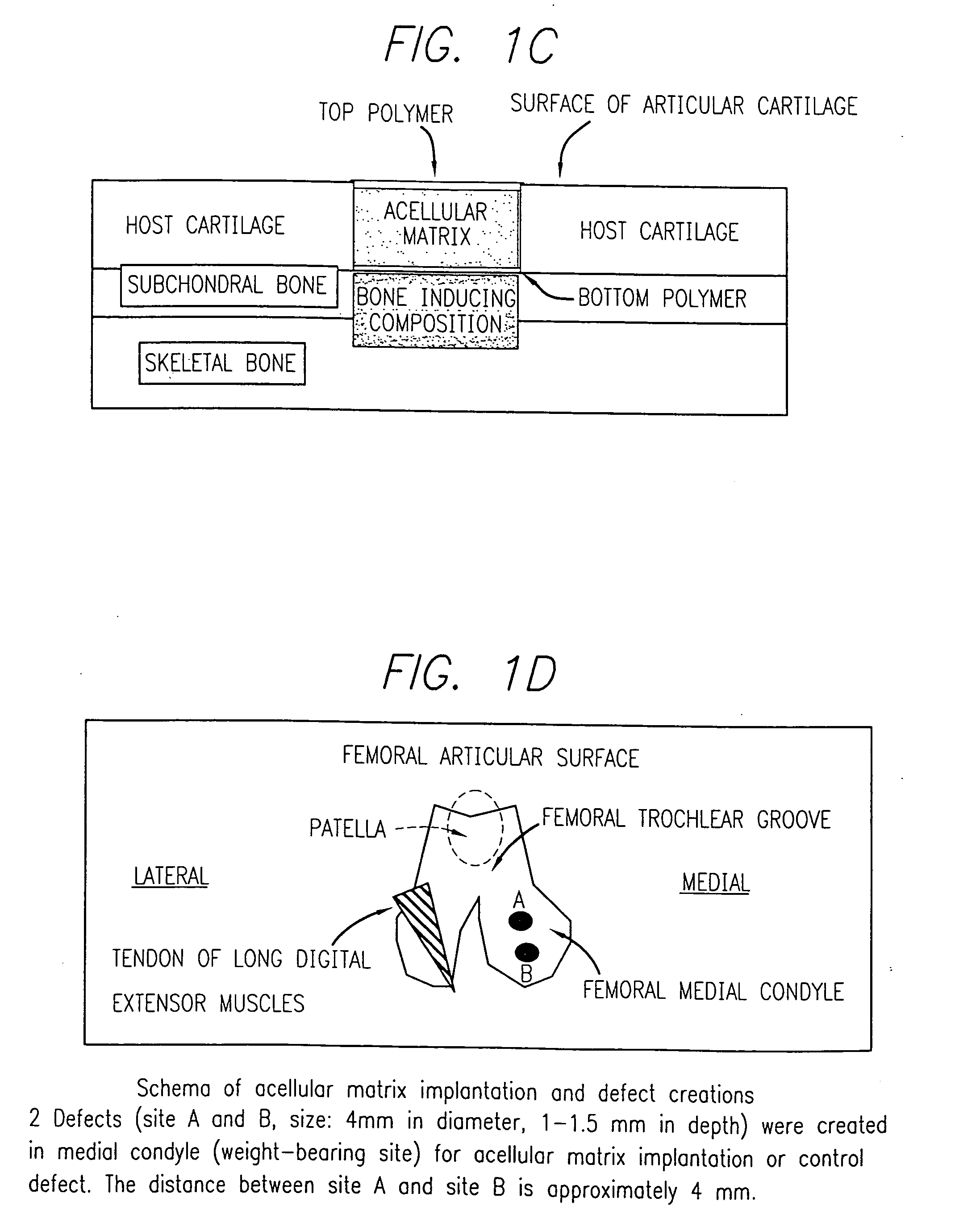 Acellular matrix implanted into an articular cartilage or osteochondral lesion protected with a biodegradable polymer modified to have extended polymerization time and methods for preparation and use thereof
