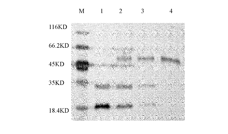 Method for separating and purifying high-purity activated clotting seventh factors from cell culture solution or plasma components