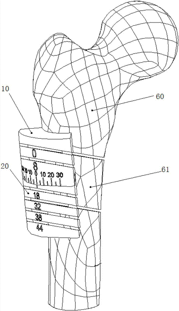 Rotary bone-cutting guide plate with precise measurement