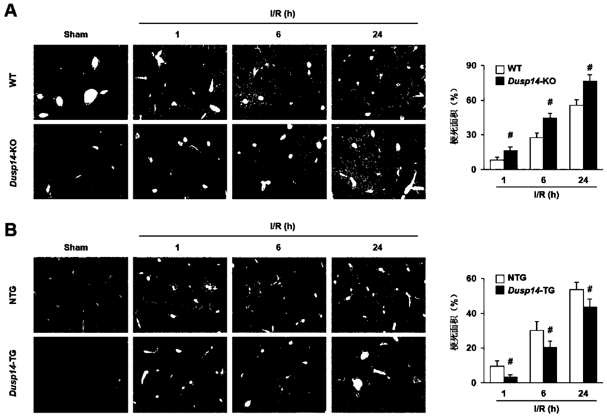 Application of dual specificity phosphatase 14 (dusp14) in liver ischemia-reperfusion injury