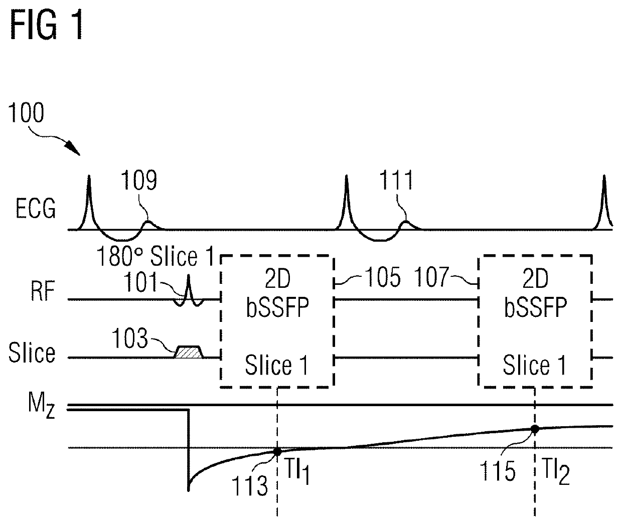 Method of performing magnetic resonance imaging and a magnetic resonance apparatus