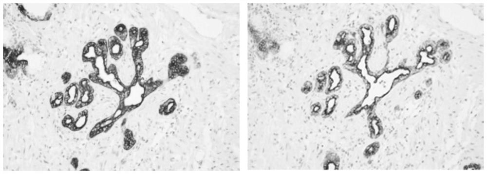 Antibody diluent for immunohistochemical detection and preparation method and application thereof