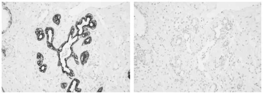 Antibody diluent for immunohistochemical detection and preparation method and application thereof