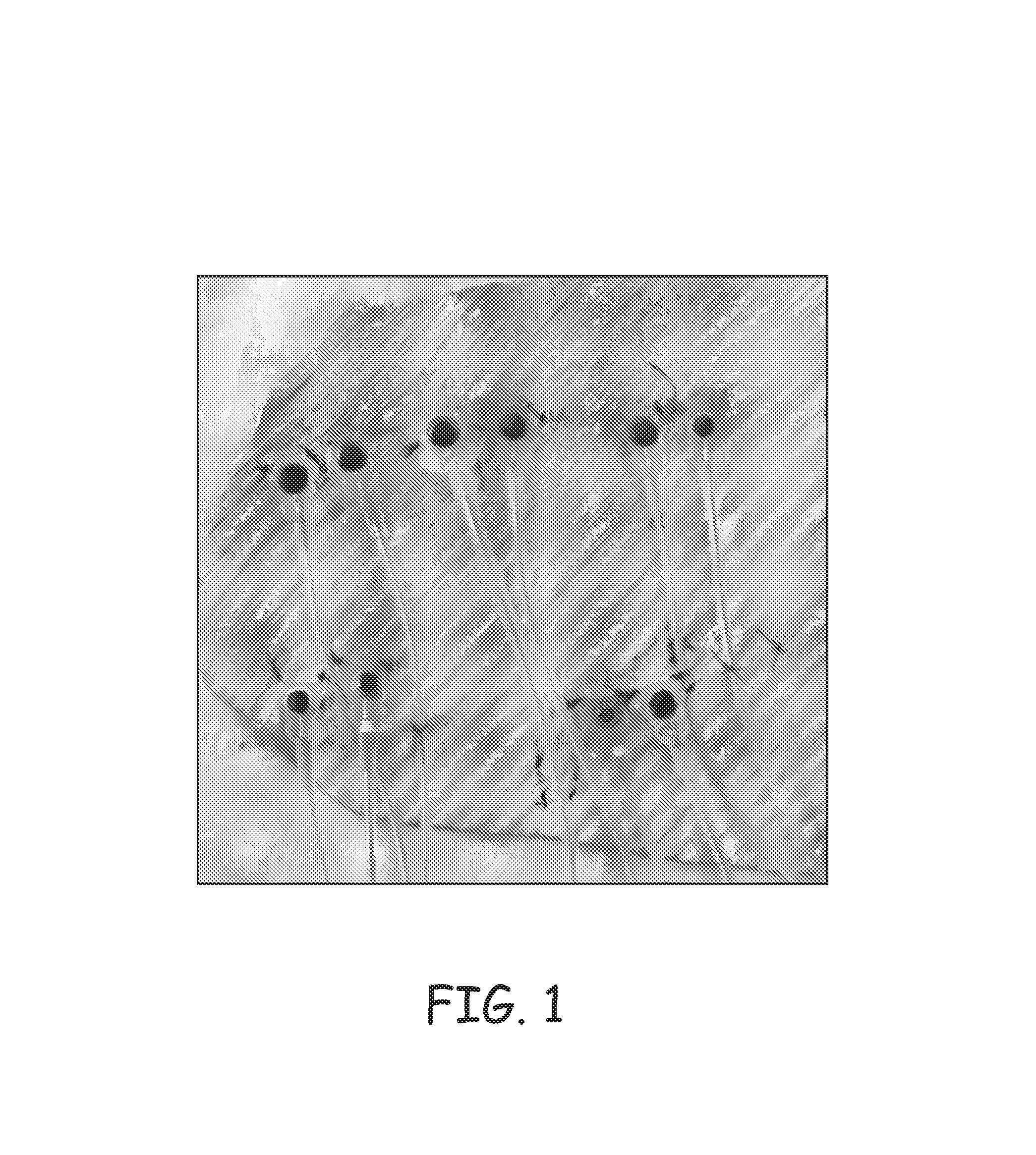Methods for optimization of biventricular pacing devices and systems useful therefor