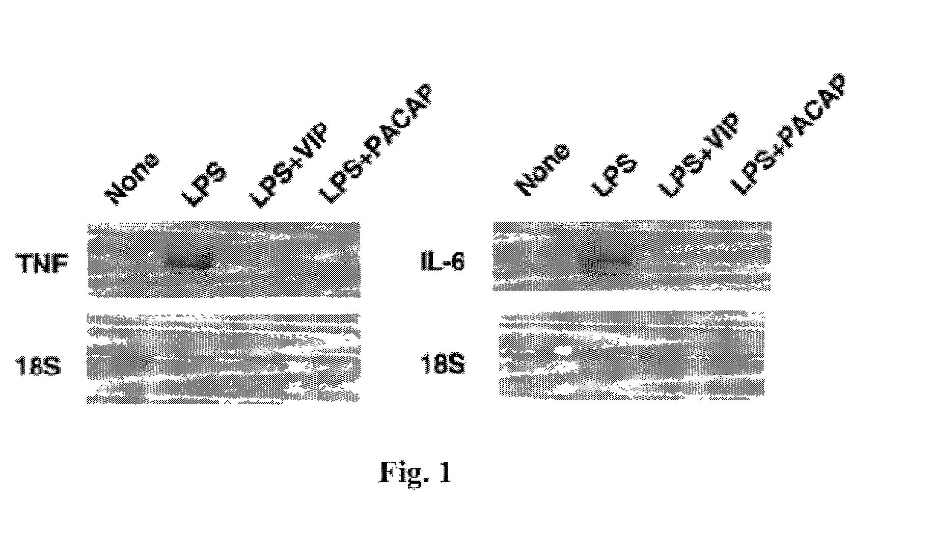 Method for treating and preventing septic shock with VPAC1R, VPAC2R and PAC1R agonists