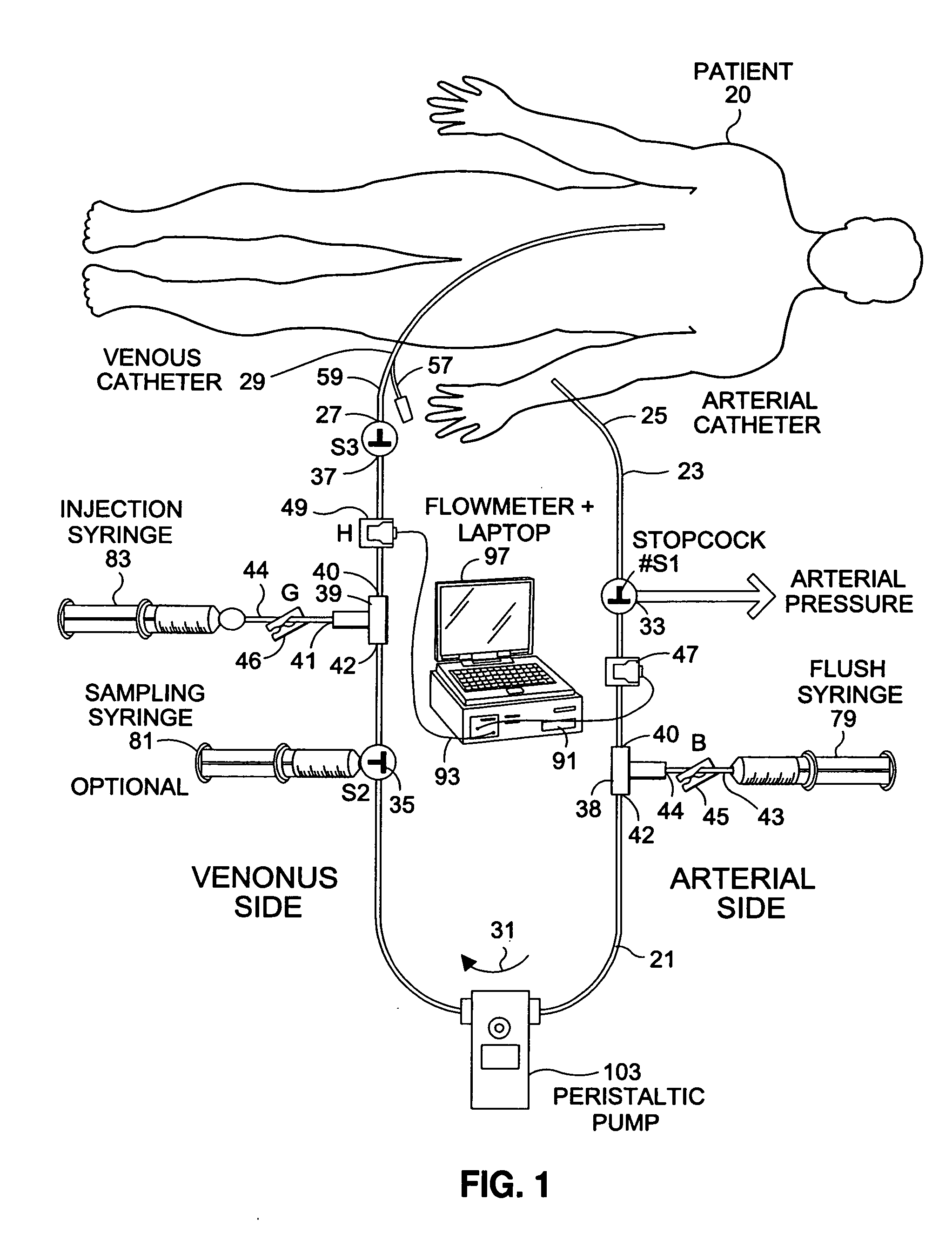 System and method for diverting flow to facilitate measurement of system parameters
