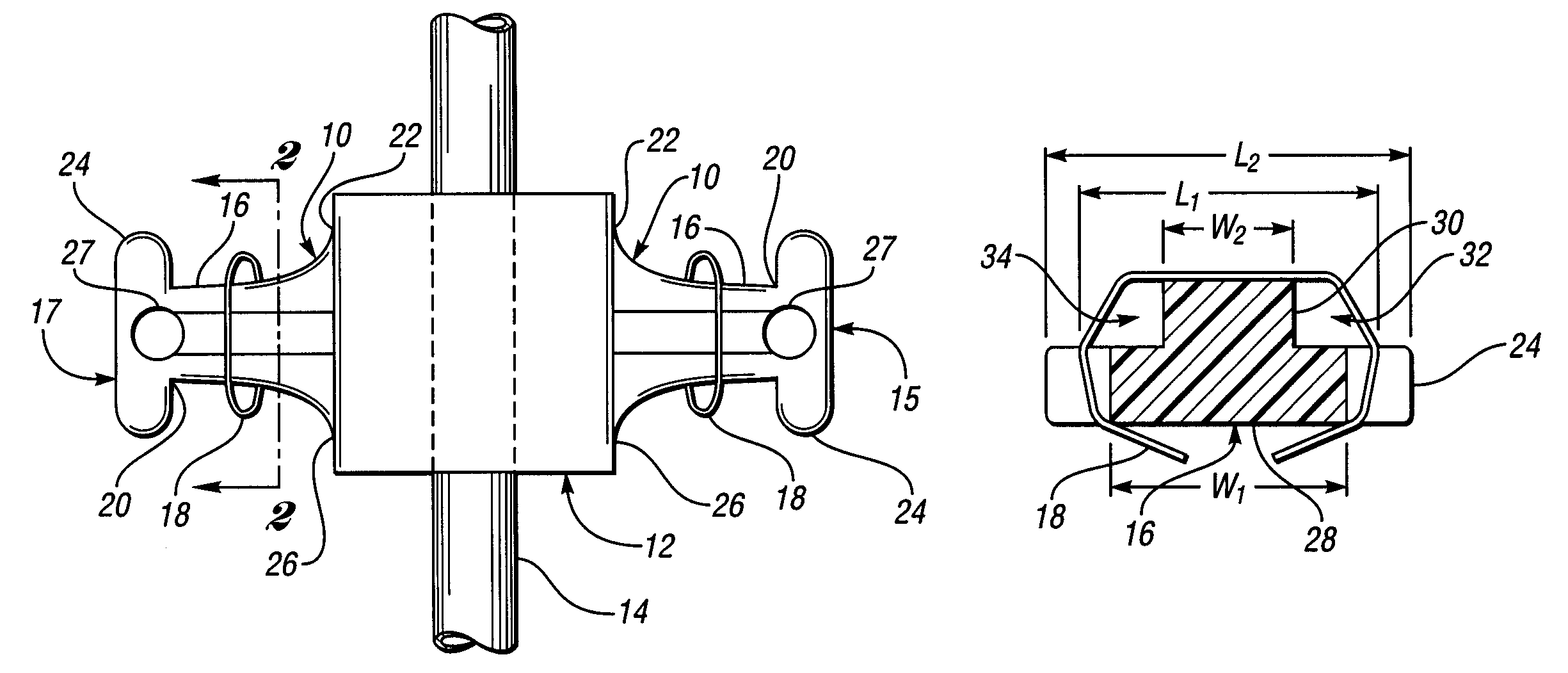 Fixation apparatus for a medical device