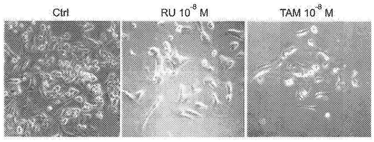 Methods and compositions for treating antiprogestin-resistant cancers