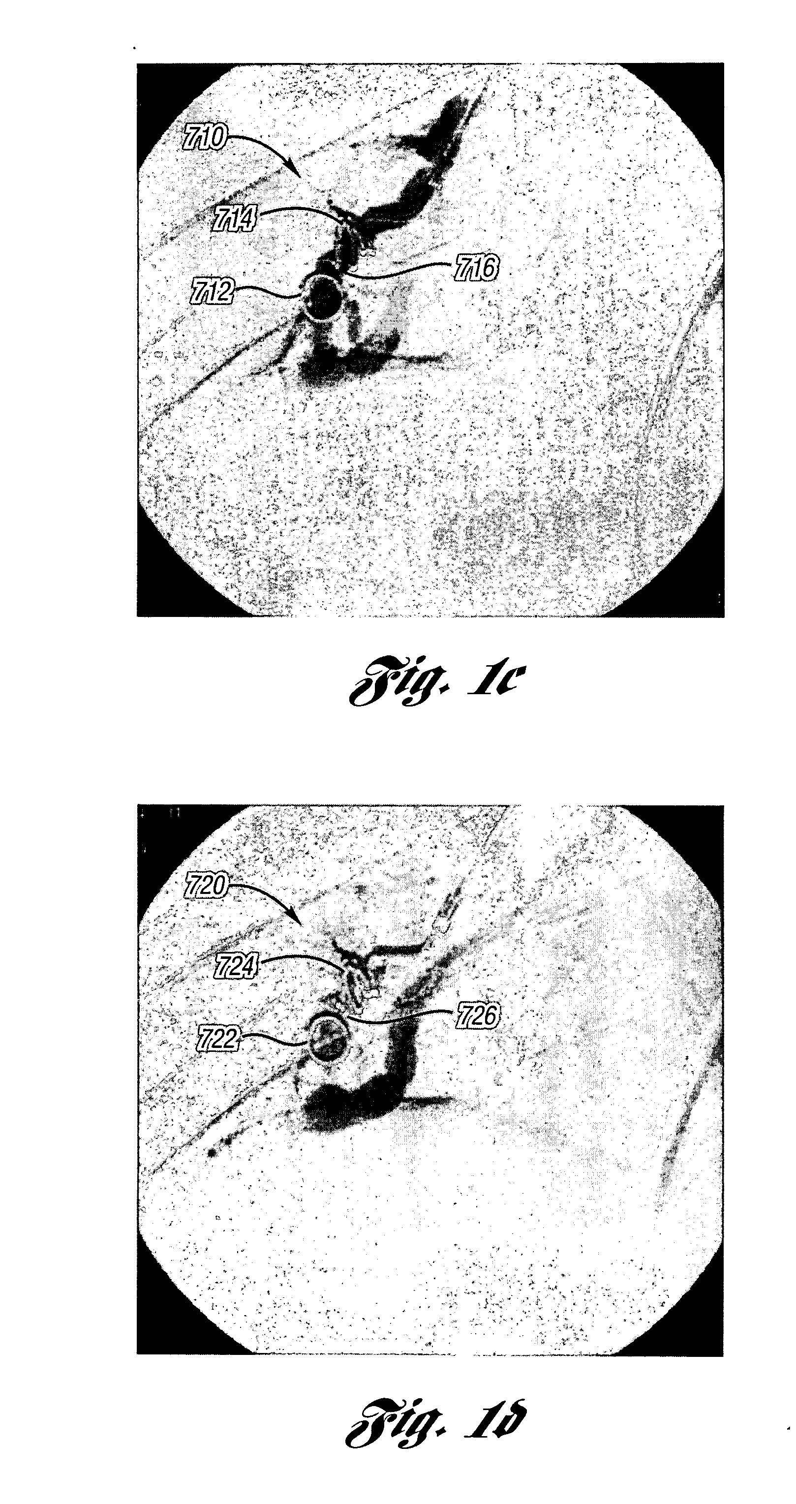 Occluding device and method of occluding fluid flow through a body vessel